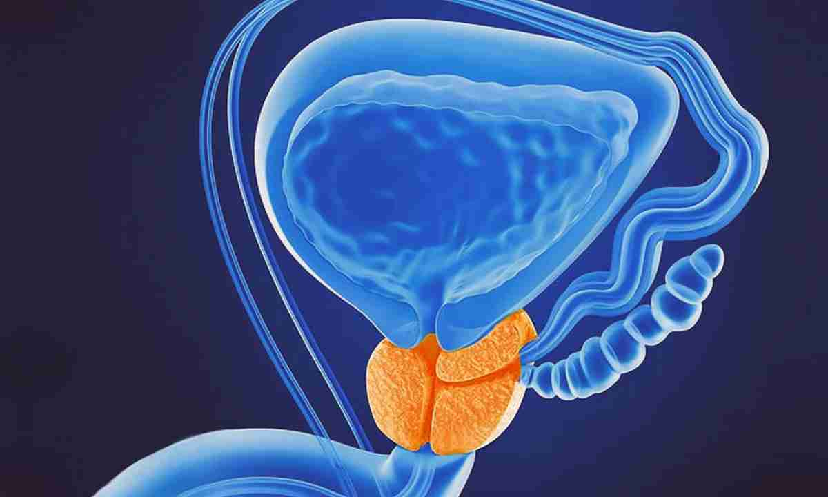 전립선암 원인